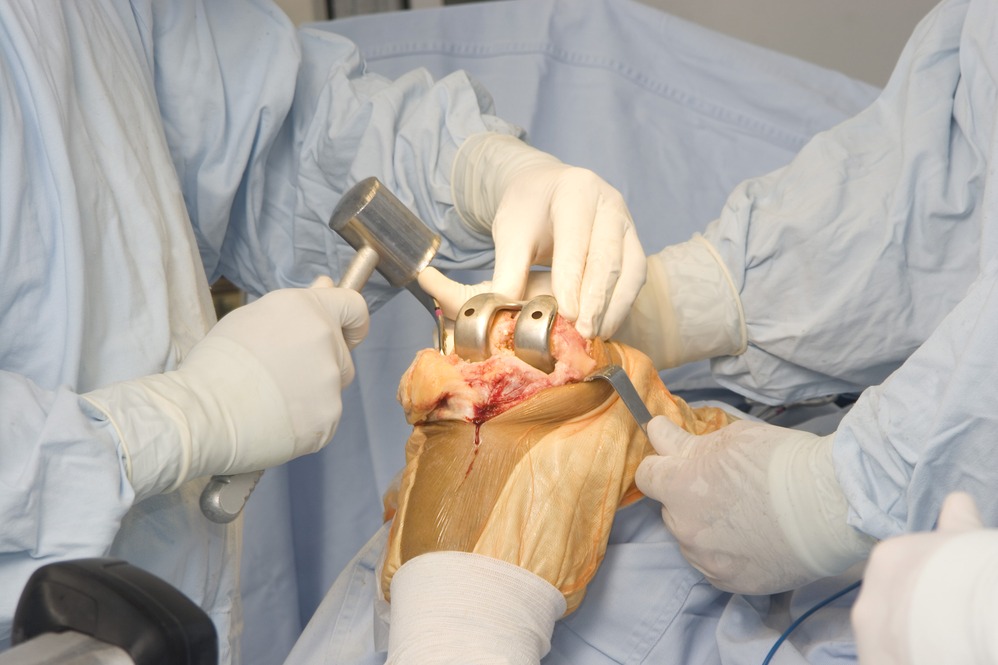 Best Sports Injury Surgeon in Gaur City main image