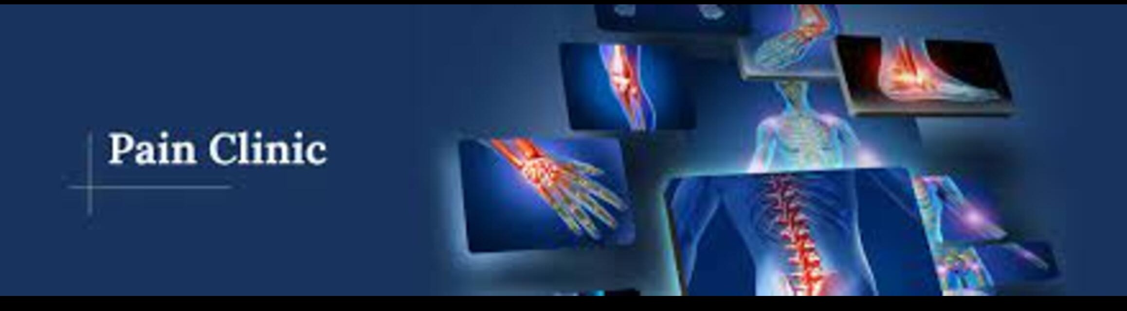 Pain Clinic in Pune – Comprehensive Pain Care U... main image