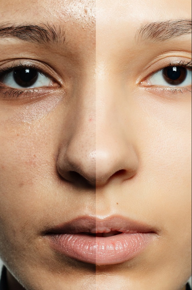 Skin Lightening in Dwarka, Delhi: Even-Toned Radia... main image