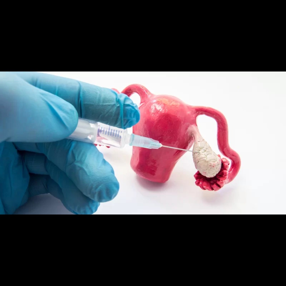 Ovarian Stimulation

Normally, a woman after attai... main image