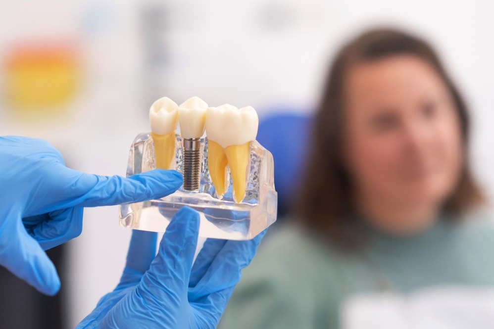 Long-Lasting Dental Implants Treatment in Nagpu... main image