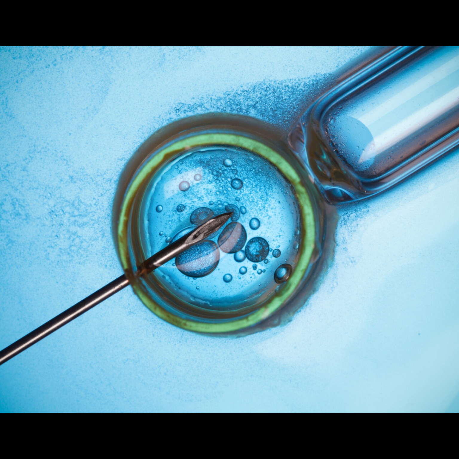 ICSI Treatment – Intracytoplasmic Sperm Injection
... main image