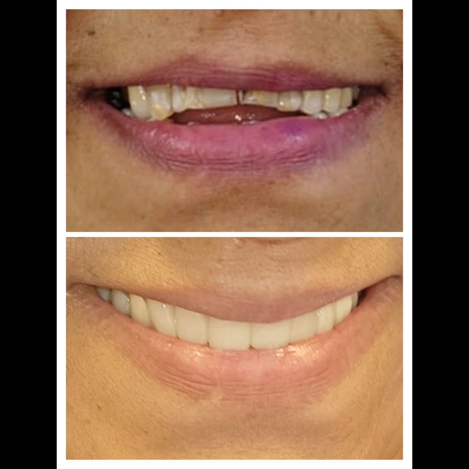 update image