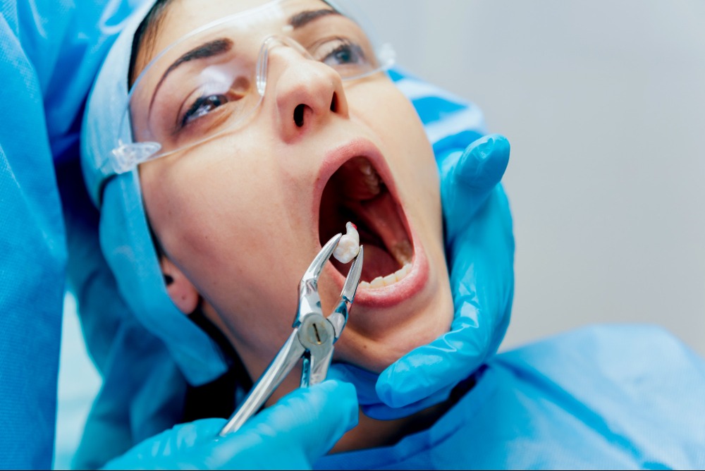 Wisdom Teeth Extraction in Vishnu Garden – Safe... main image
