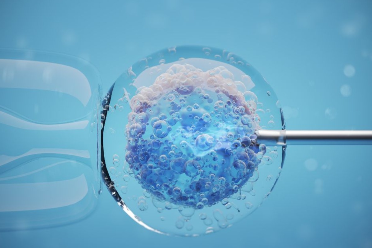 IMSI- Intracytoplasmic Morphologically Selected Sp... main image