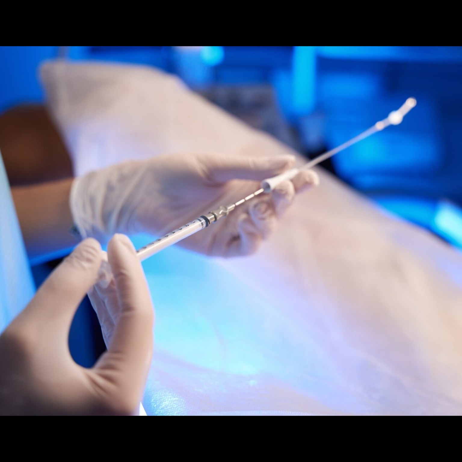 Embryo Transfer Procedure

Uterine Embryo Transfer... main image