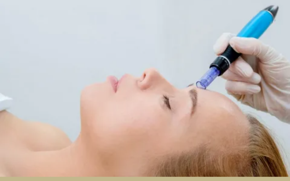 BEST MICRONEEDLING TREATMENT IN NASHIK . Microneed... main image