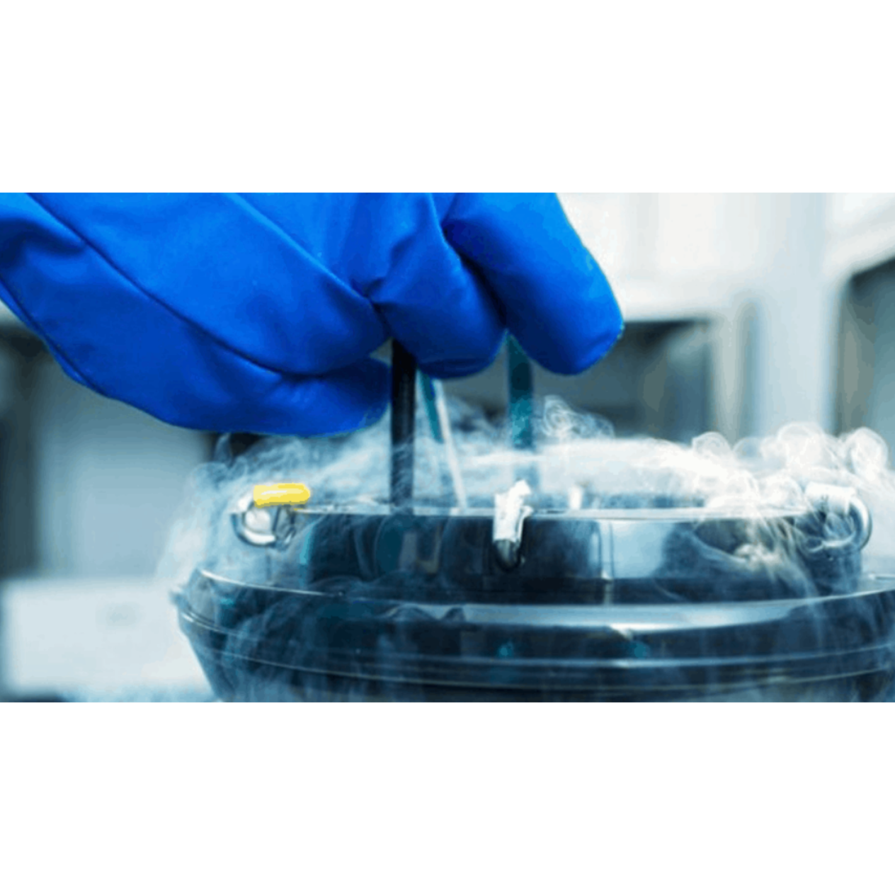 Cryopreservation – Vitrification

Cryopreservation... main image
