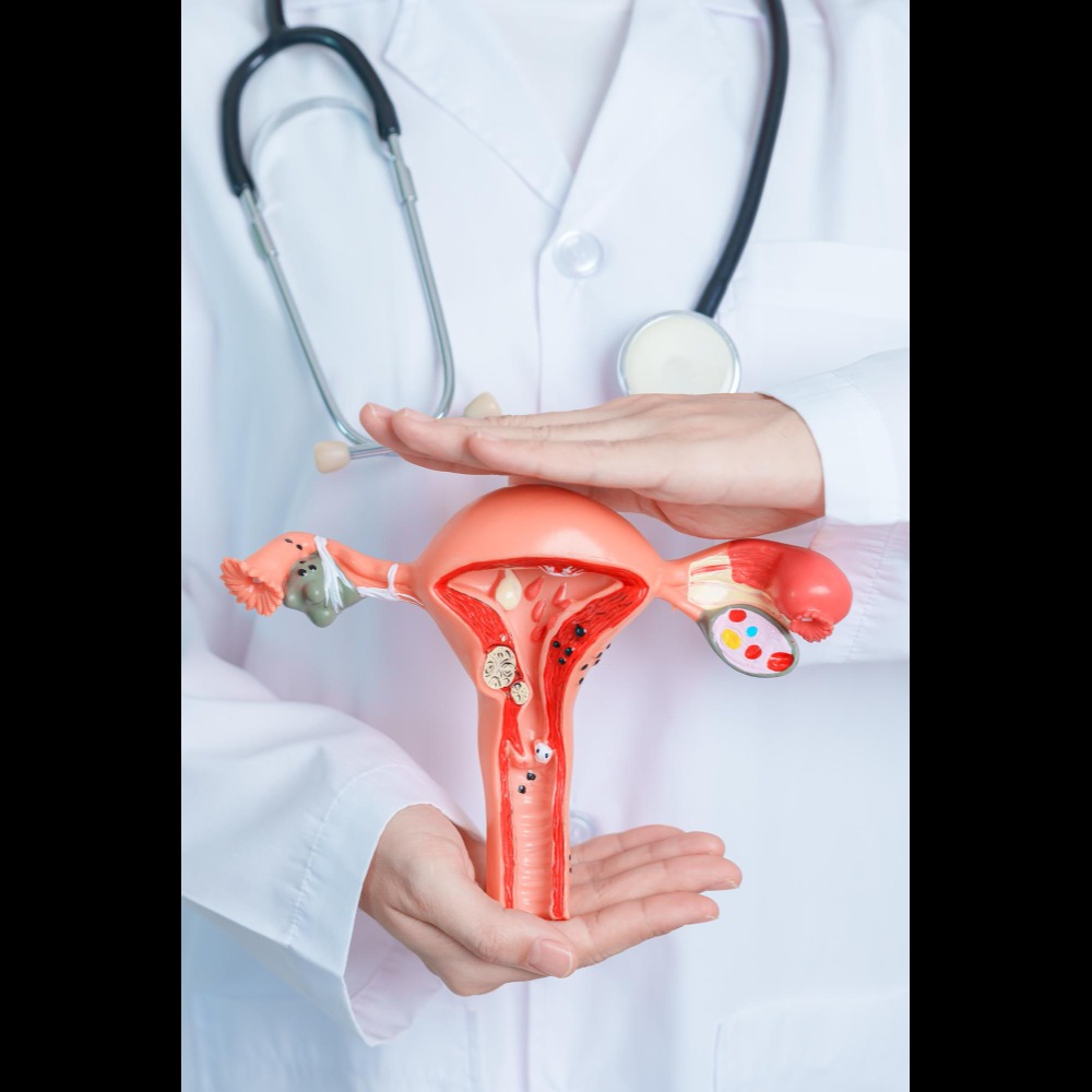 PCOD Treatment in Chennai for Hormonal Balance ... main image