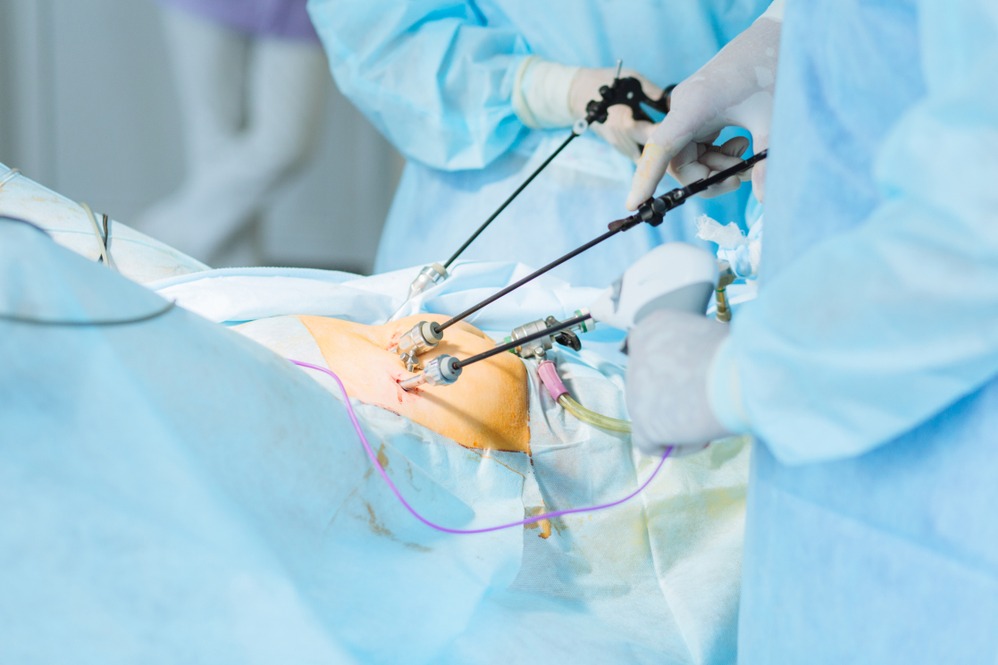 Advanced Hystero-Laparoscopy

Hysteroscopy and lap... main image