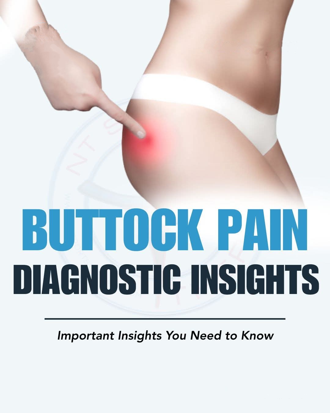 Buttock Pain: Diagnostic Insights Buttock pain isn... main image