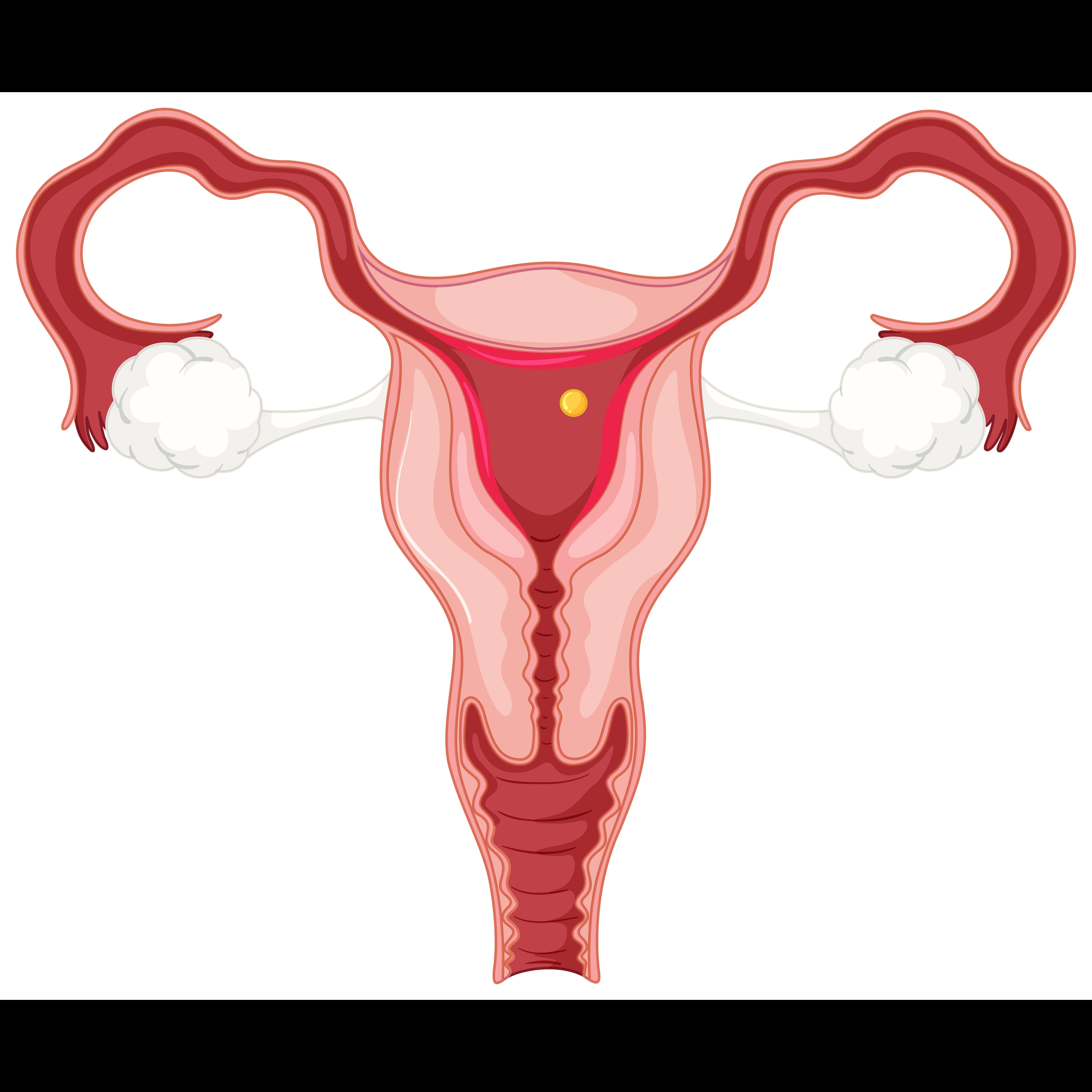 PCOS Management in Chennai – Restore Hormonal Bala... main image