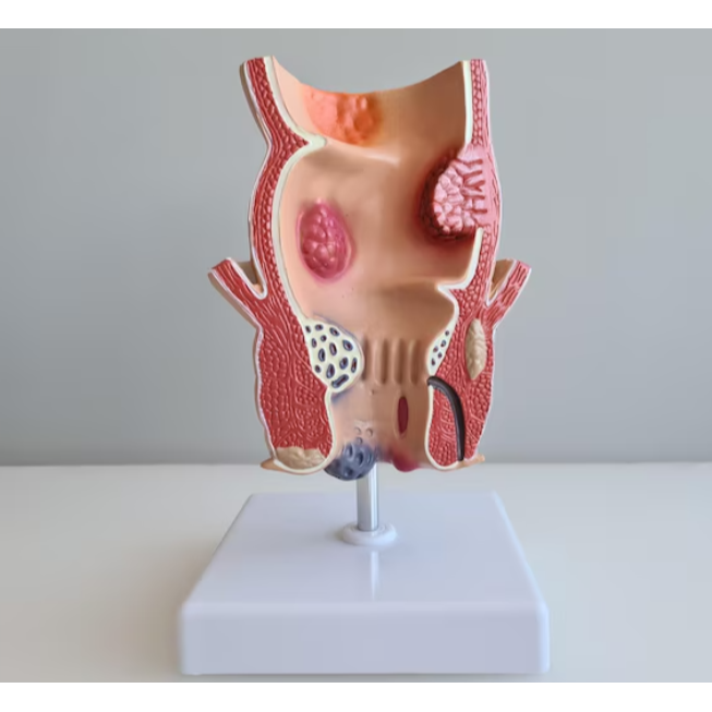 Relief from Piles with Expert Surgical Care in Nas... main image