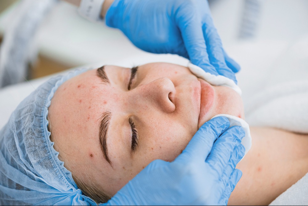 Top Dermatologist in Chennai for Acne and Skin ... main image