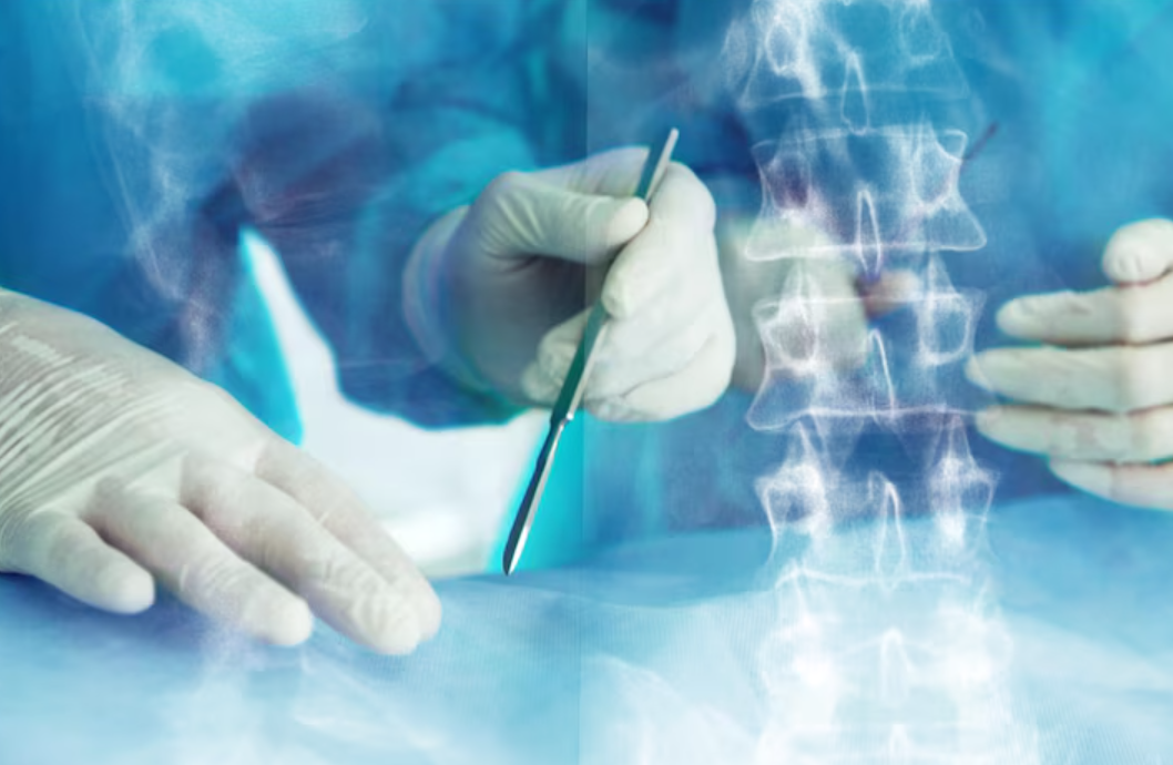Minimally Invasive Spine Surgeon in Jaipur for Fas... main image