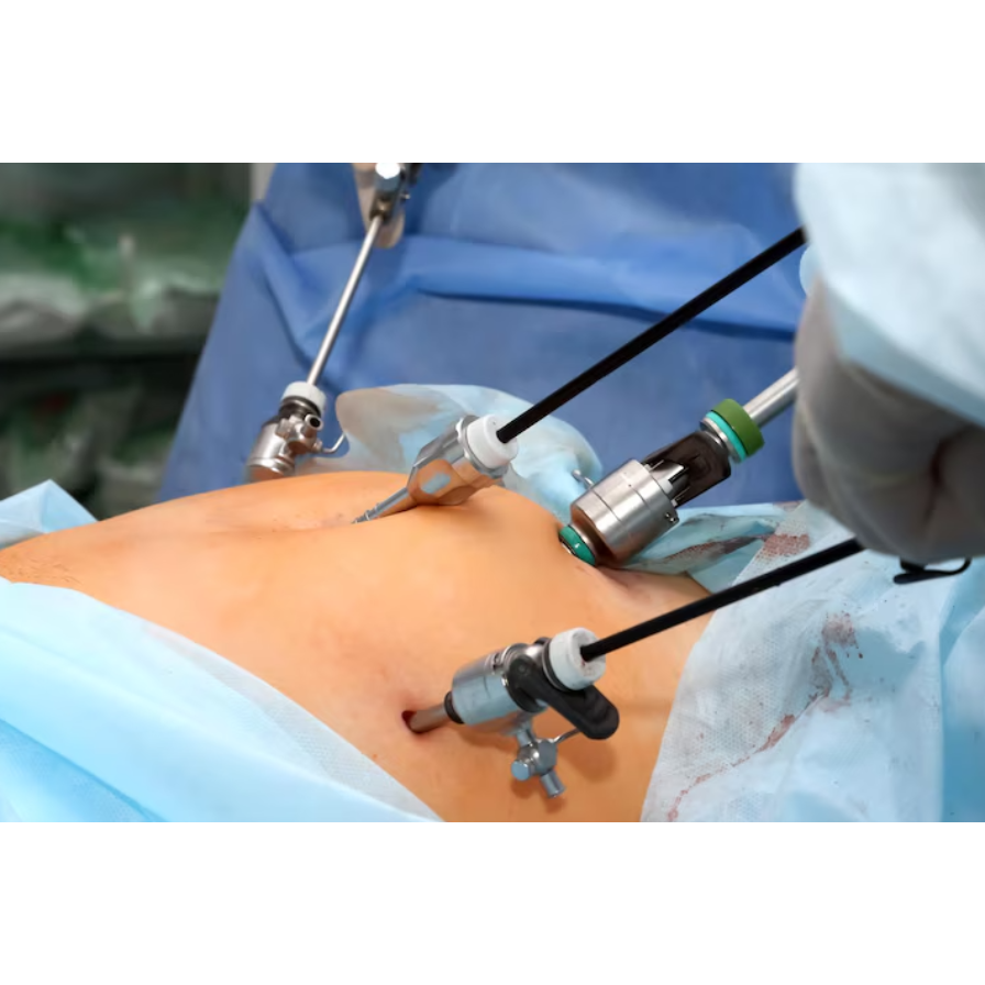 Precision Healing with Laparoscopic Surgery in Nav... main image