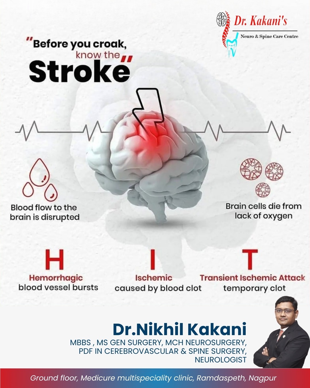 Before You Croak, Know the Stroke – Stroke Trea... main image