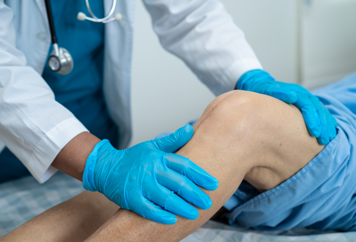 Knee Replacement Surgery in Chennai at KC Hospital... main image