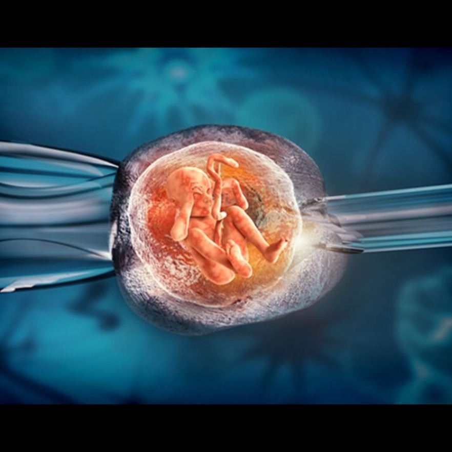 In Vitro Fertilisation For Infertility

In Vitro F... main image