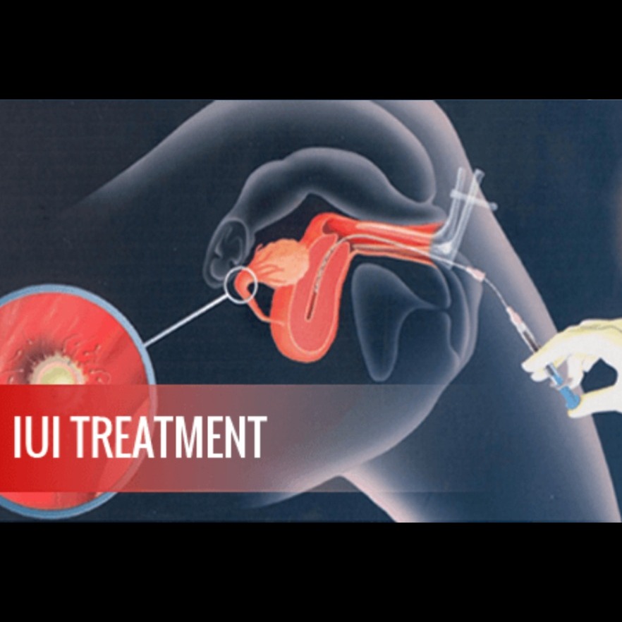 IMSI – Overcome Infertility And Build Your Family
... main image