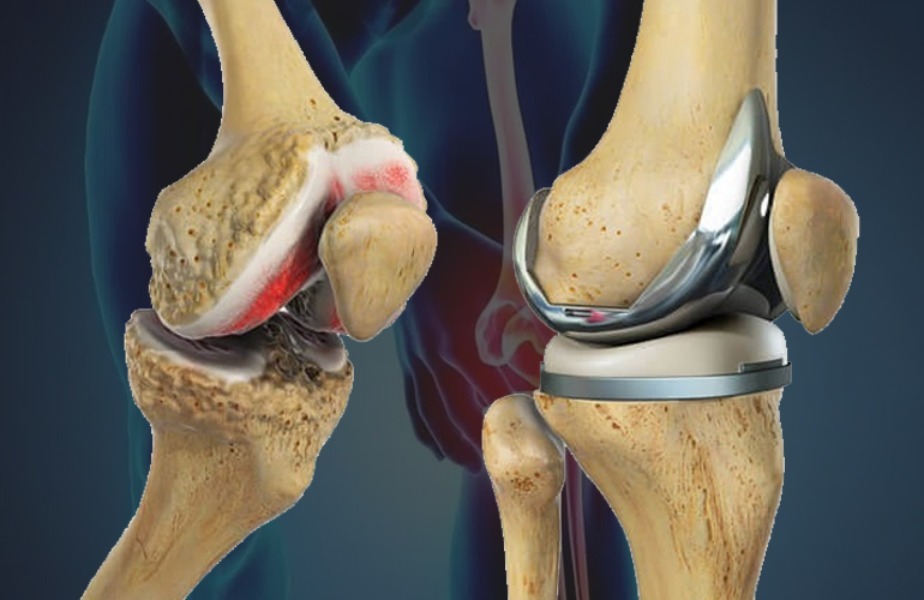Best Joint Replacement And Trauma Center In Nas... main image