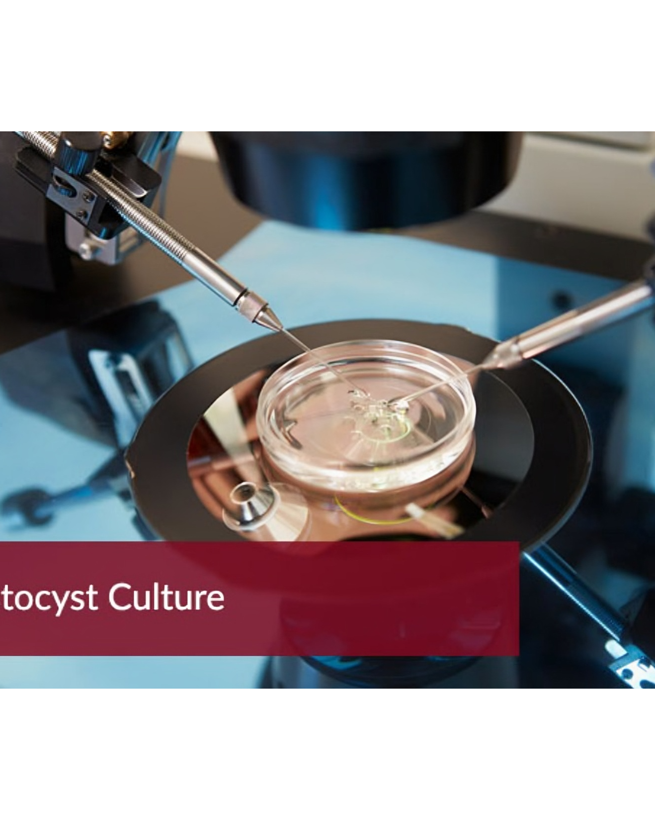 A Promising Procedure To Cure Infertility : Blasto... main image