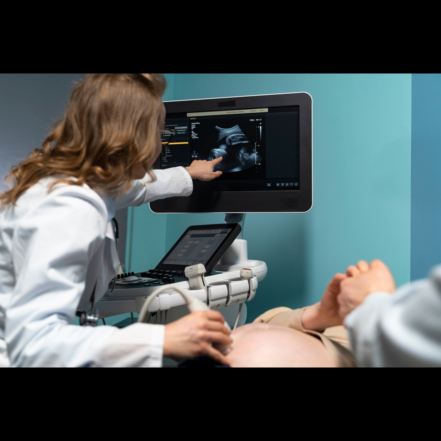 3D Pelvic Ultrasound (TVS) in Chennai – Advanced I... main image