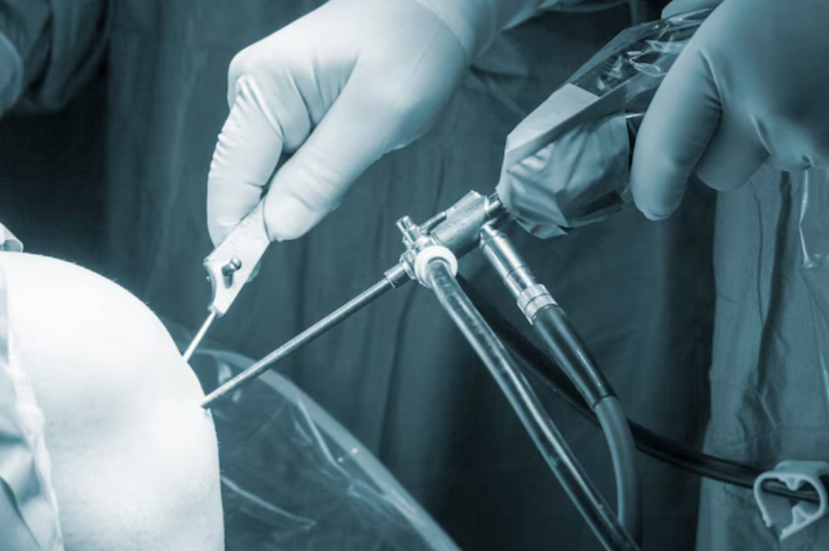 Keyhole Surgery in Chennai Keyhole surgery, also k... main image