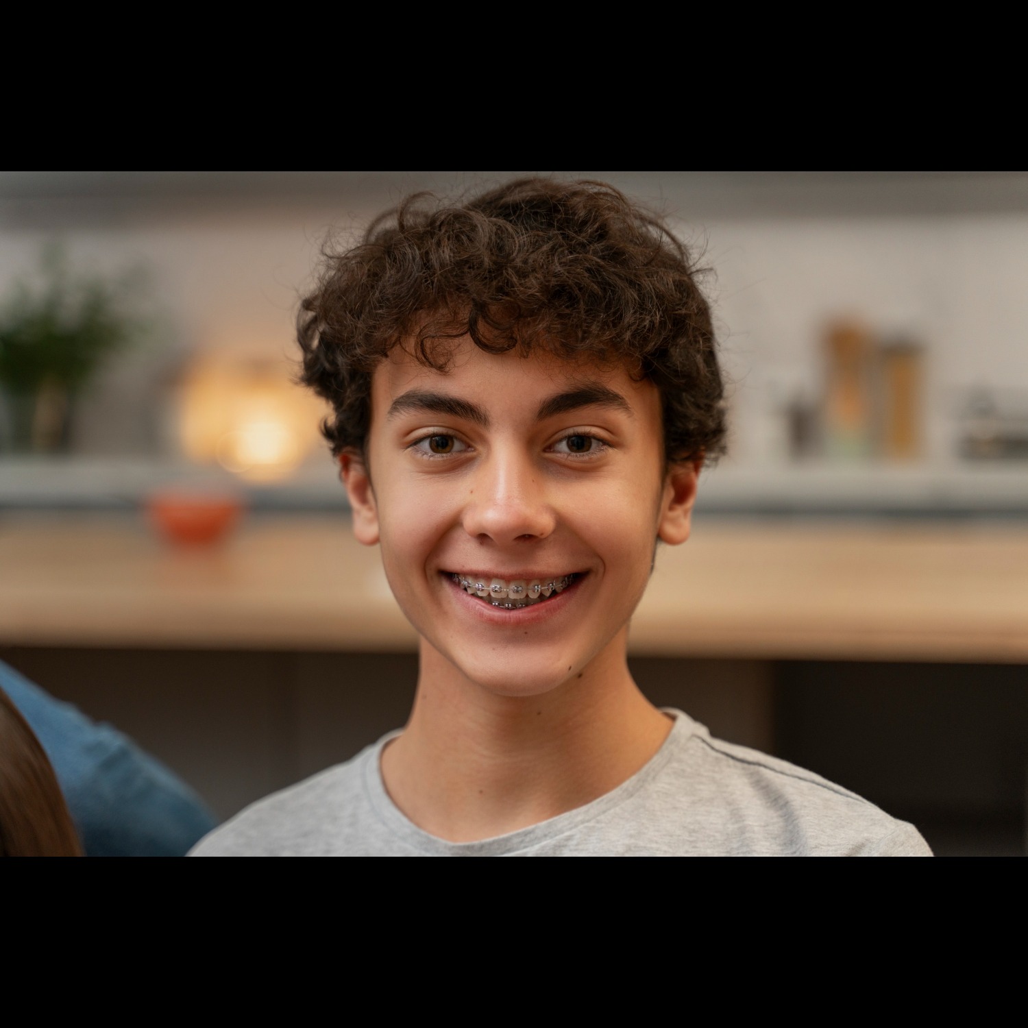 Teeth Alignment Treatment in Mahavir Nagar – St... main image