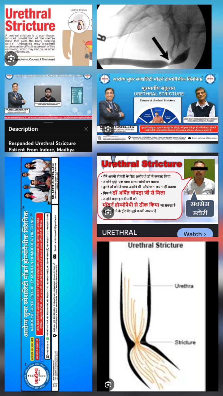 update image