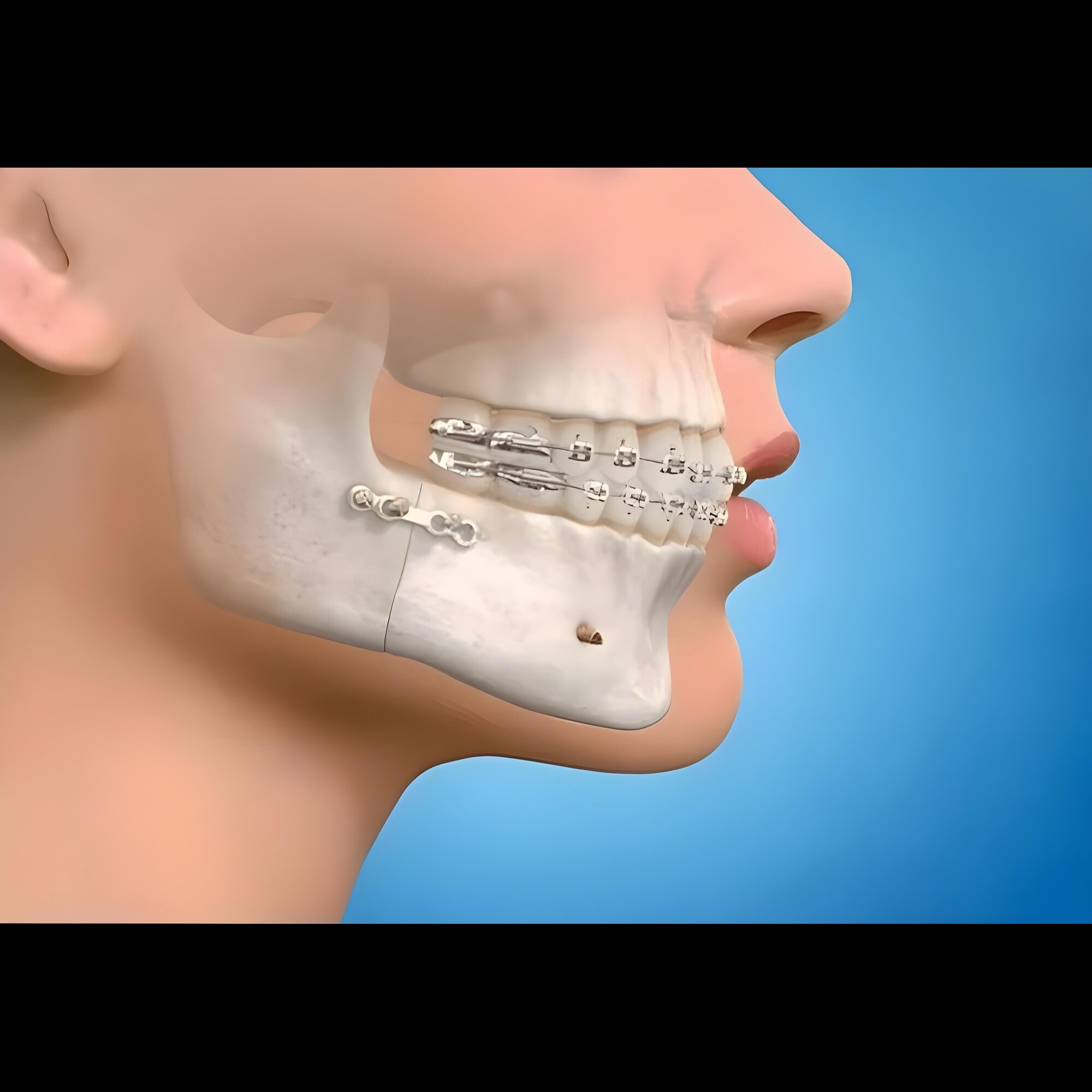 Trusted Maxillofacial Surgery Experts in Pimpri fo... main image