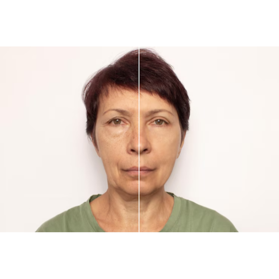 Anti-Aging Skin Treatments in Nashik – Look Younge... main image
