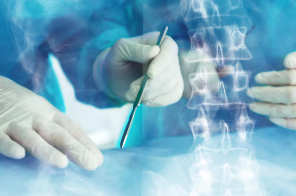 Minimally Invasive Spine Surgeon in Jaipur for Fas... main image