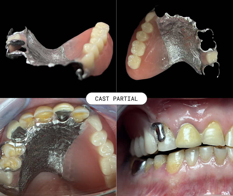 update image