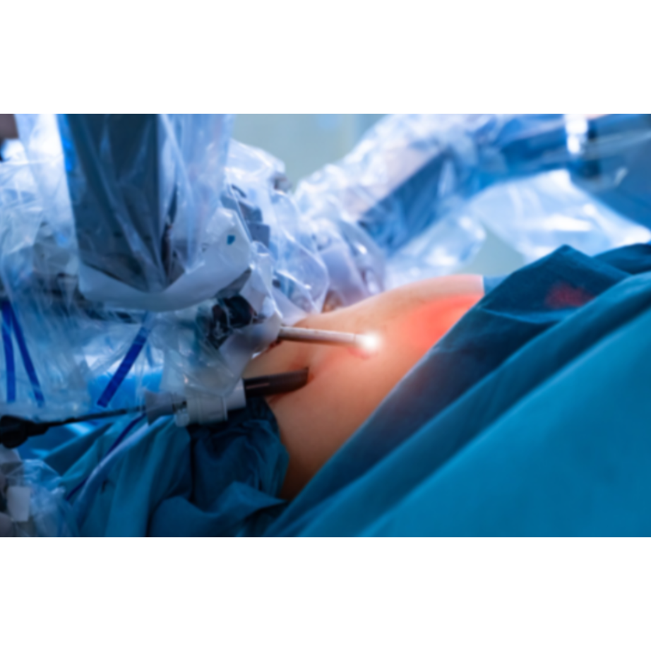 Laparoscopic Surgery in Pune Looking for laparo... main image
