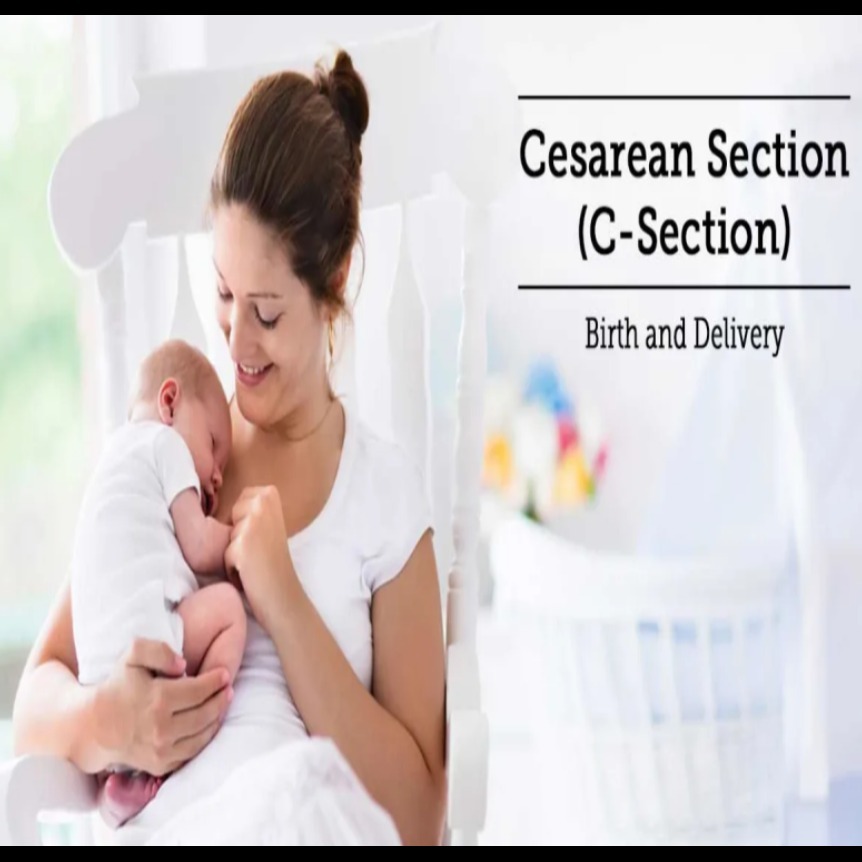 Cesarean Delivery Services in Nagpur – Safe and Re... main image