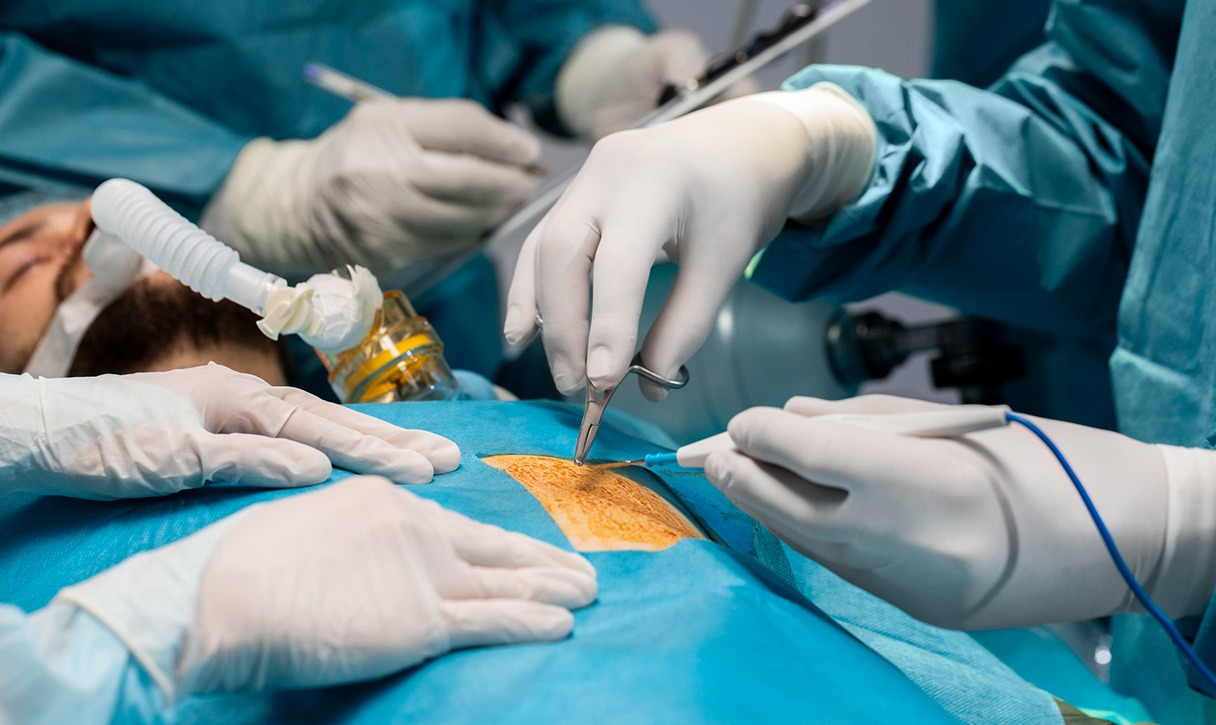 Laparoscopic Surgery In Pimpri Chinchwad Pune L... main image