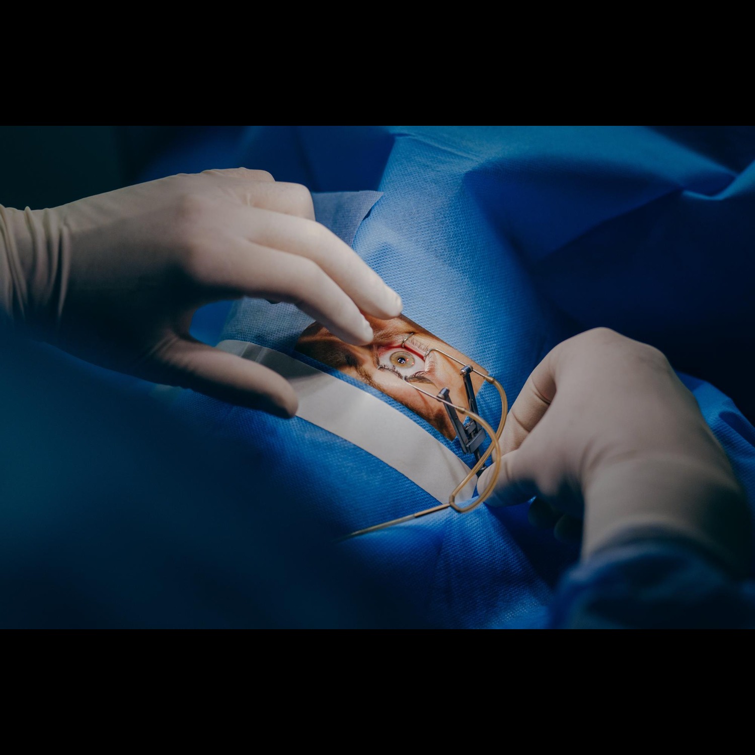 Multifocal and Toric IOL Surgery in Nagpur – Perso... main image