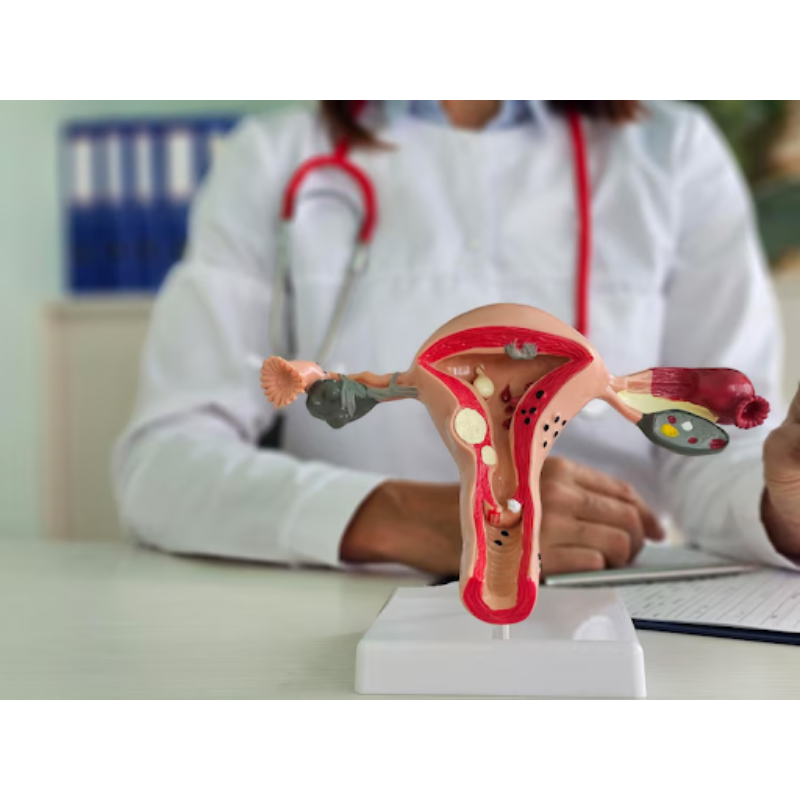 PCOD Treatment in Pune – Targeted Hormonal and Fer... main image