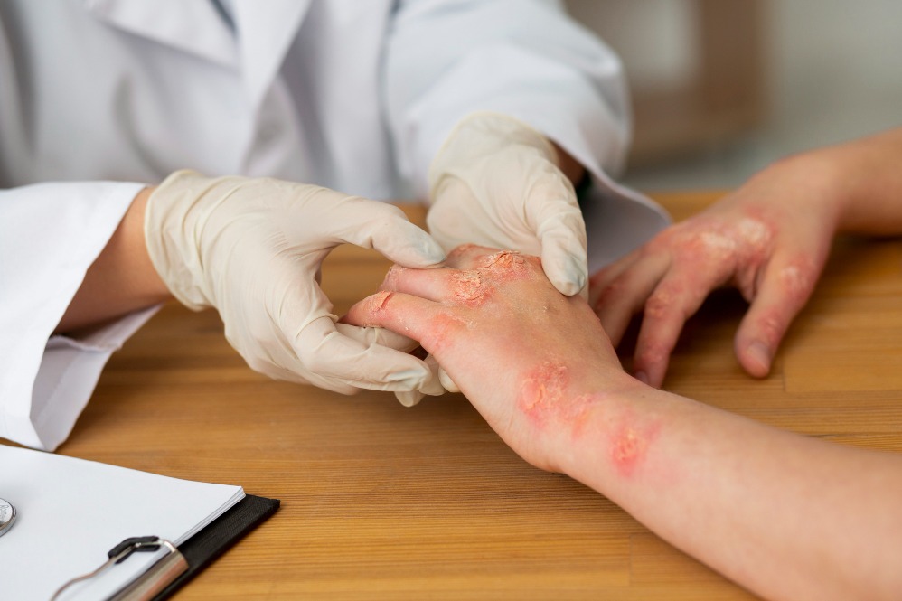 Discover the Best Skin Allergy Doctor Near You in ... main image