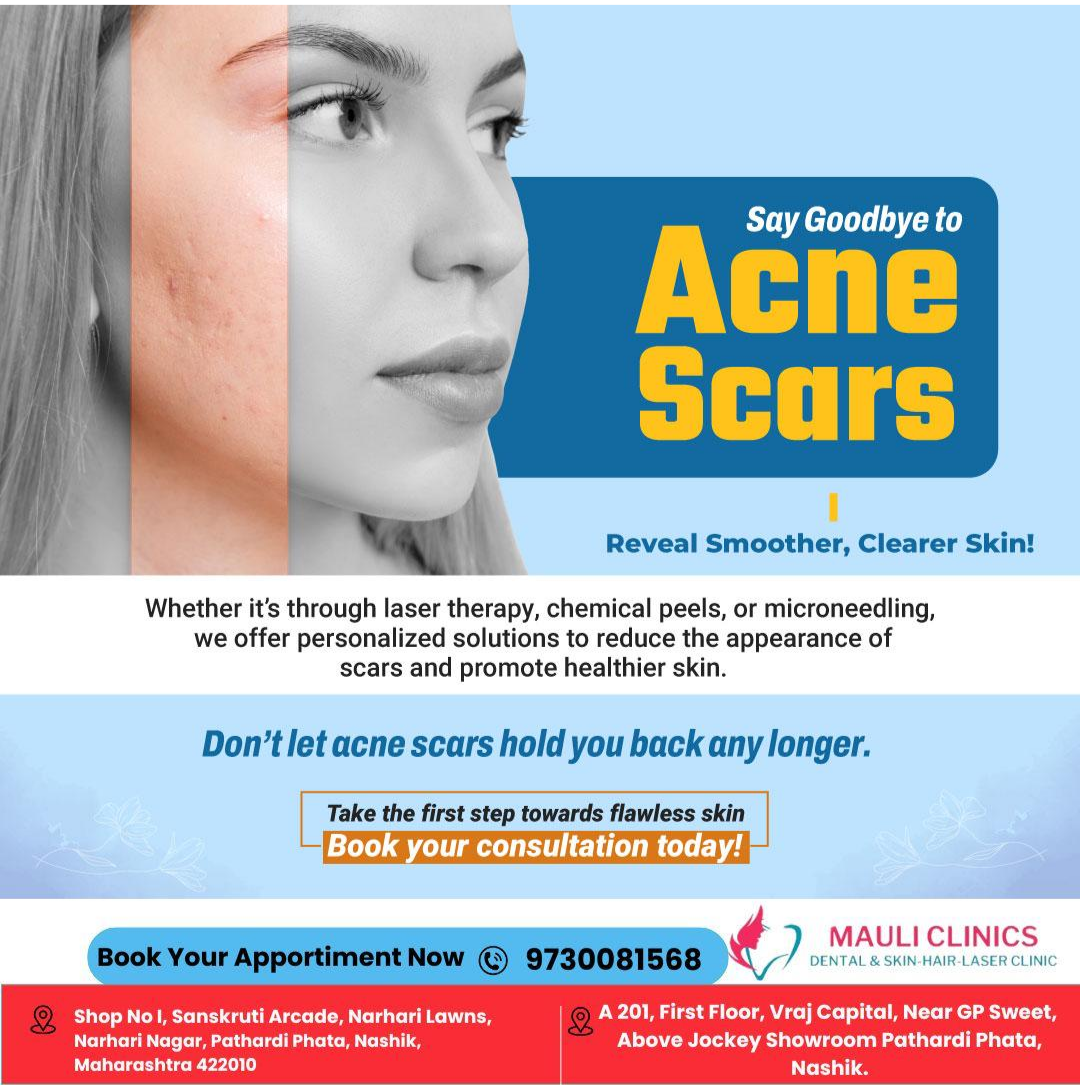 ACNE SCAR TREATMENT IN NASHIK . Say goodbye to acn... main image