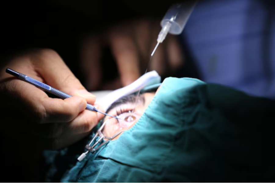 Cataract Surgery Consultation in Bannerghatta Road... main image