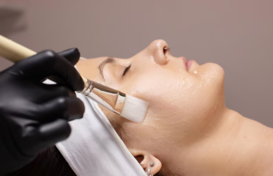 Advanced Chemical Peels in Delhi – Renew and Revea... main image