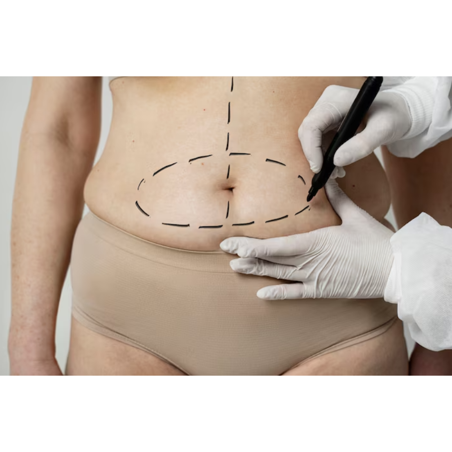 Chennai Liposuction Experts Now in Boat Club For t... main image