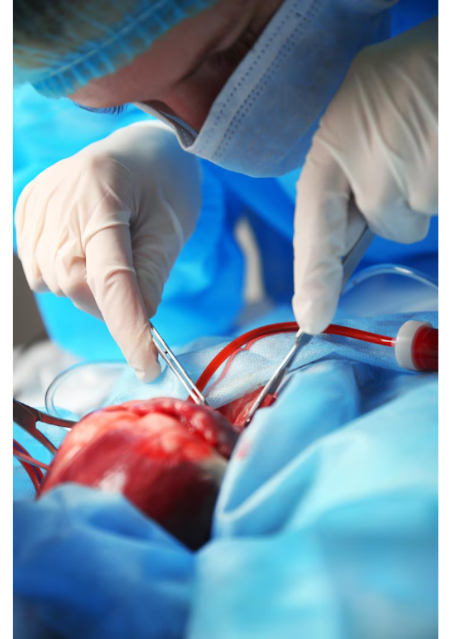 Small Incision Cardiac Surgery in Nagpur – Adva... main image