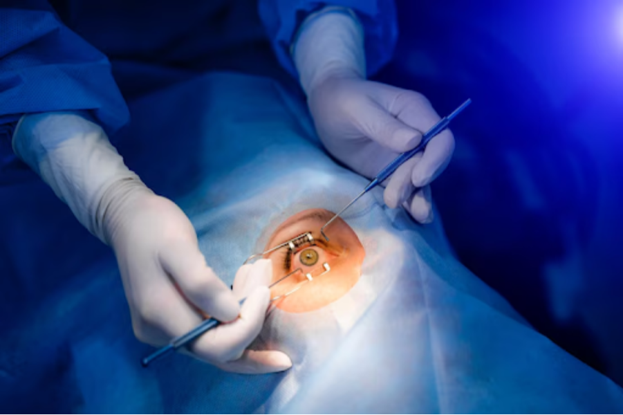 Cataract Surgery in BTM Layout – Safe and Advanced... main image