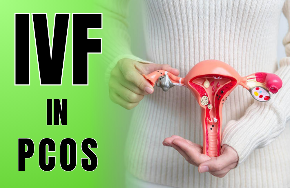 IVF treatment in Gandhipuram IVF in PCOS: Overcomi... main image