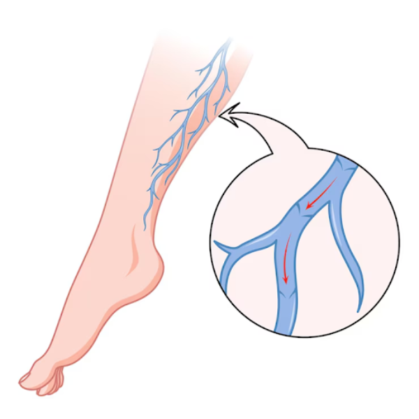 Leading Vascular Care in Pimpri for Artery and ... main image