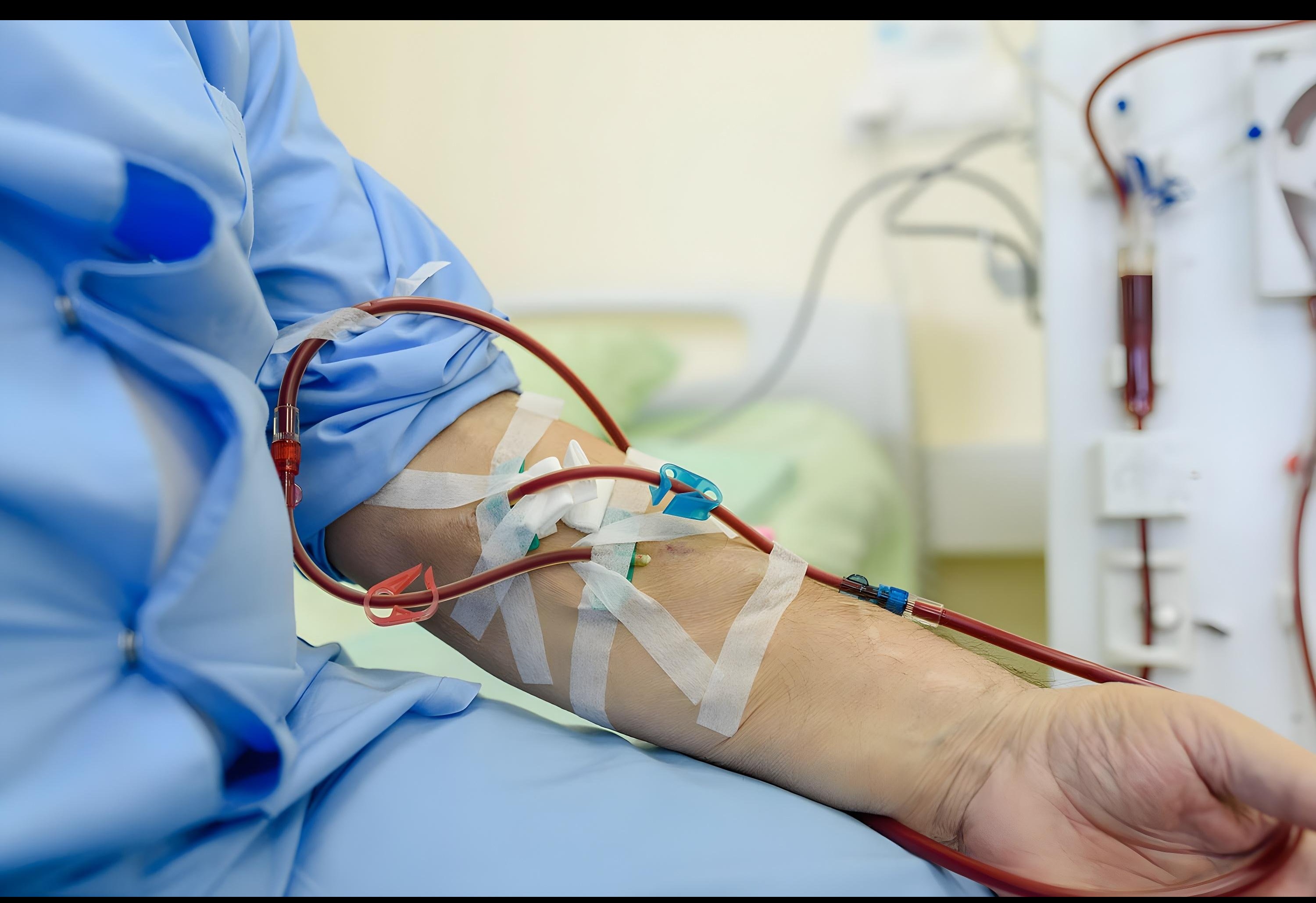 AV Fistula in Dombivli –DR HEMANT PATIL Surgical A... main image