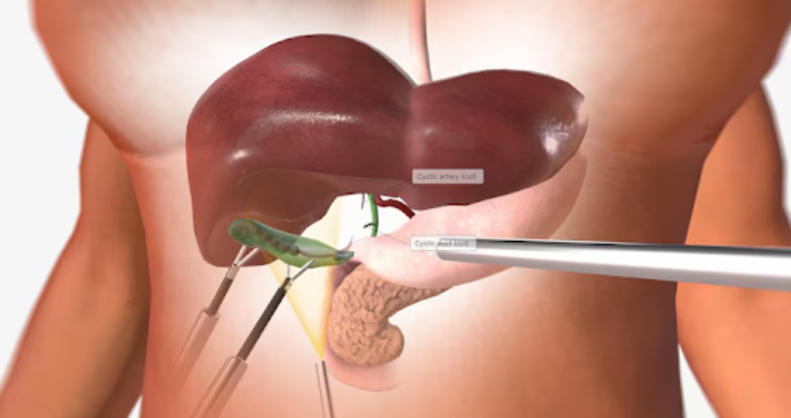 Gallbladder/Gallstone Treatment Hospital In Pun... main image